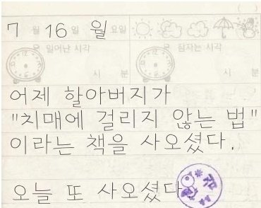 치매.jpg